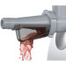 Bosch MFW68660 Fleischwolf ProPower